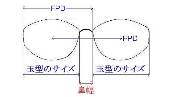 FPD（フレームPD）